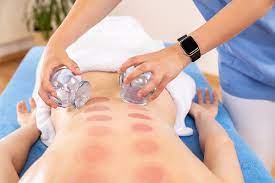 cupping services Southeast Texas, cupping therapy Beaumont SETX, cupping Lumberton TX, cupping and aeromatherapy Port Arthur,